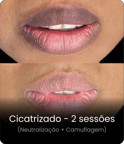 Resultado cicatrizado — neutralização