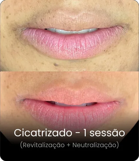 Resultado cicatrizado — neutralização
